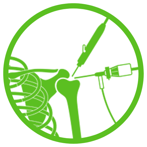 Shoulder Arthroscopy